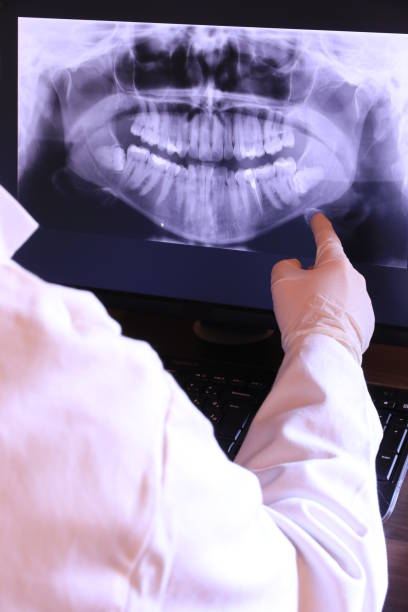 Best Emergency Dental Care for Broken or Chipped Teeth in Vincent, CA