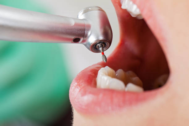 Best Same-Day Emergency Dental Services in Vincent, CA